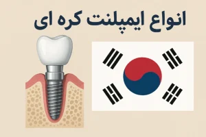 انواع ایمپلنت کره ای
