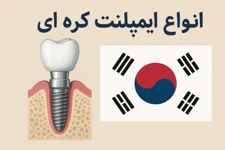 انواع ایمپلنت کره ای