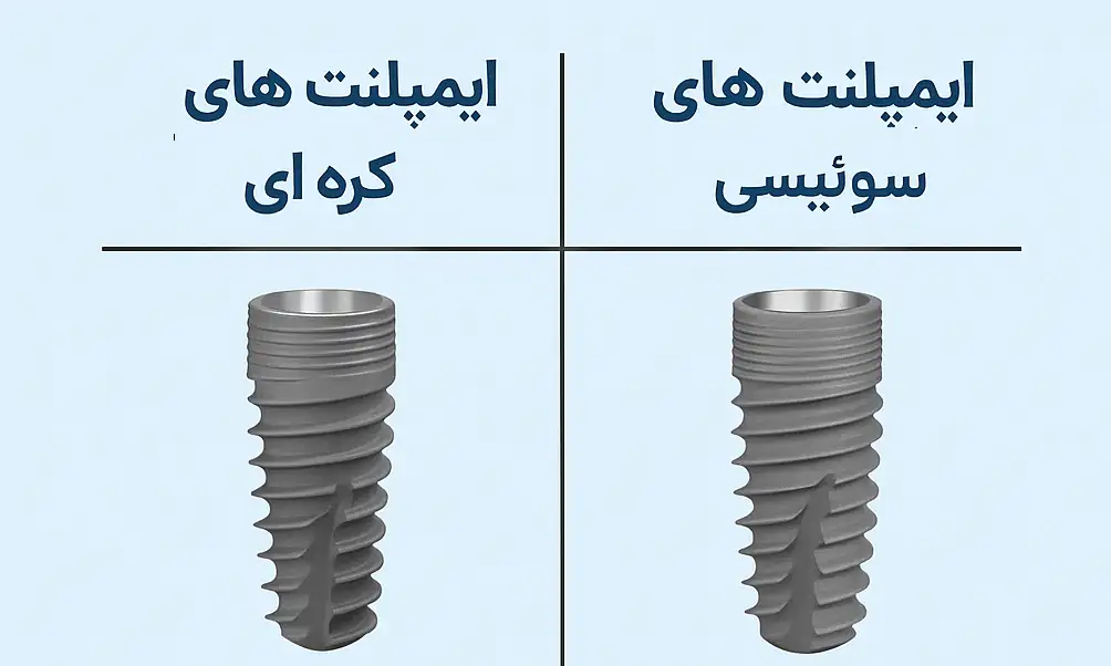 ایمپلنت کره ای یا سوئیسی