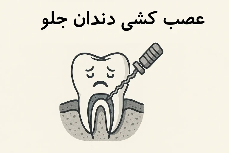 عصب کشی دندان جلو