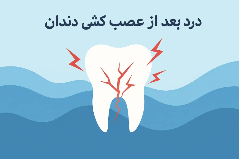 درد بعد از عصب کشی دندان