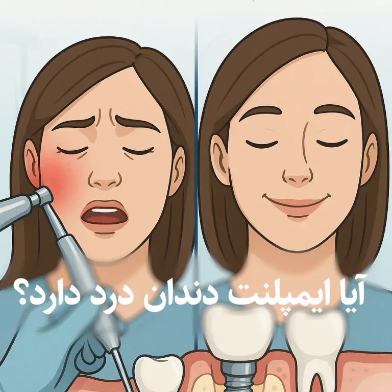 آیا ایمپلنت دندان درد دارد؟
