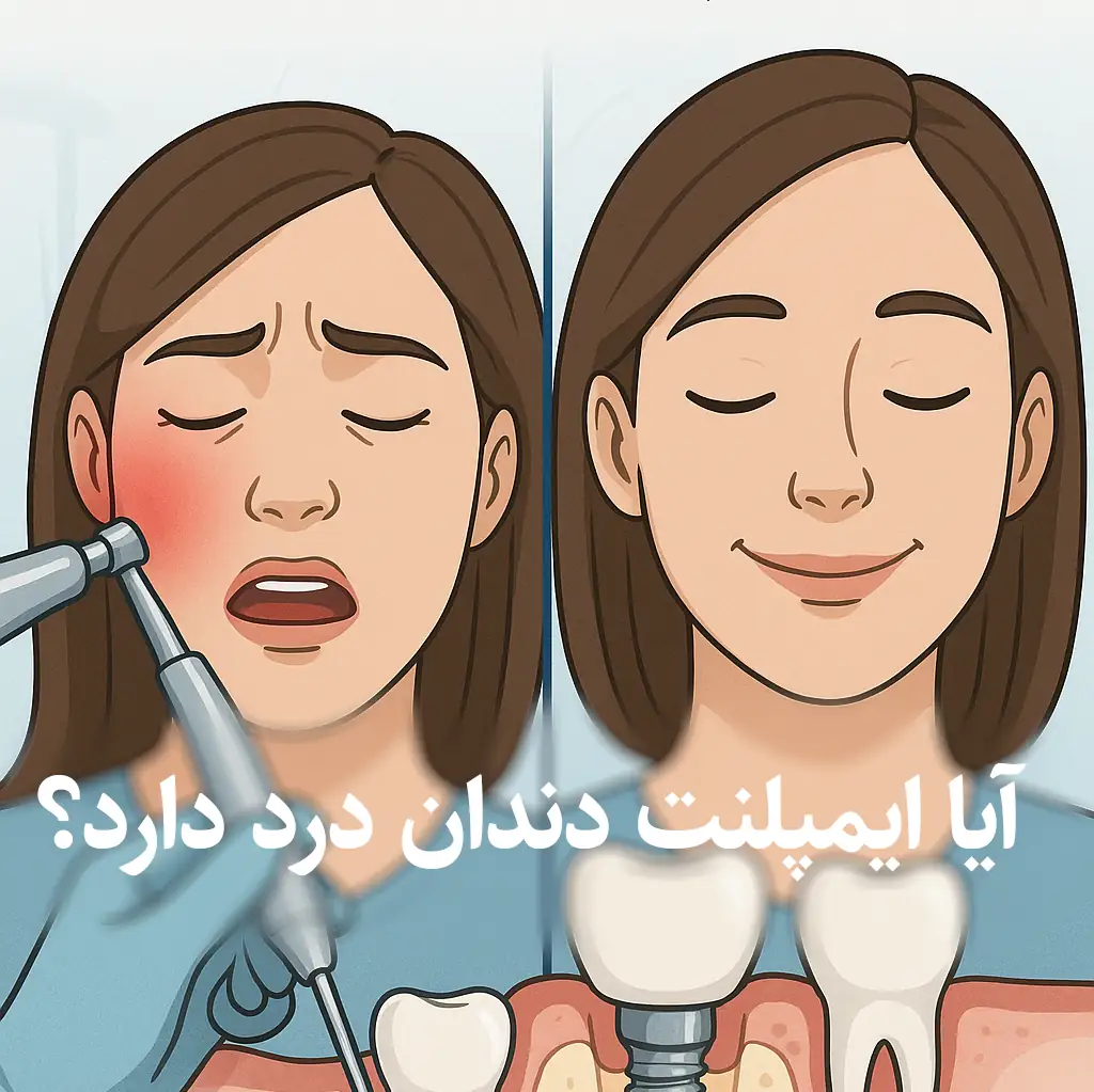 آیا ایمپلنت دندان درد دارد؟
