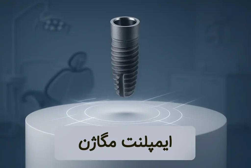 ایمپلنت مگاژن
