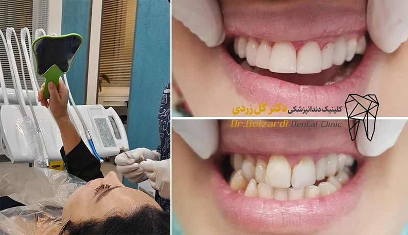 بهترین دکتر دندانپزشک رسالت