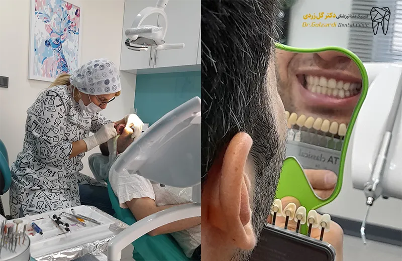 کلینیک دندانپزشکی خوب در شرق تهران