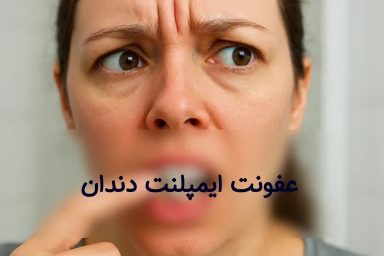 عفونت ایمپلنت دندان