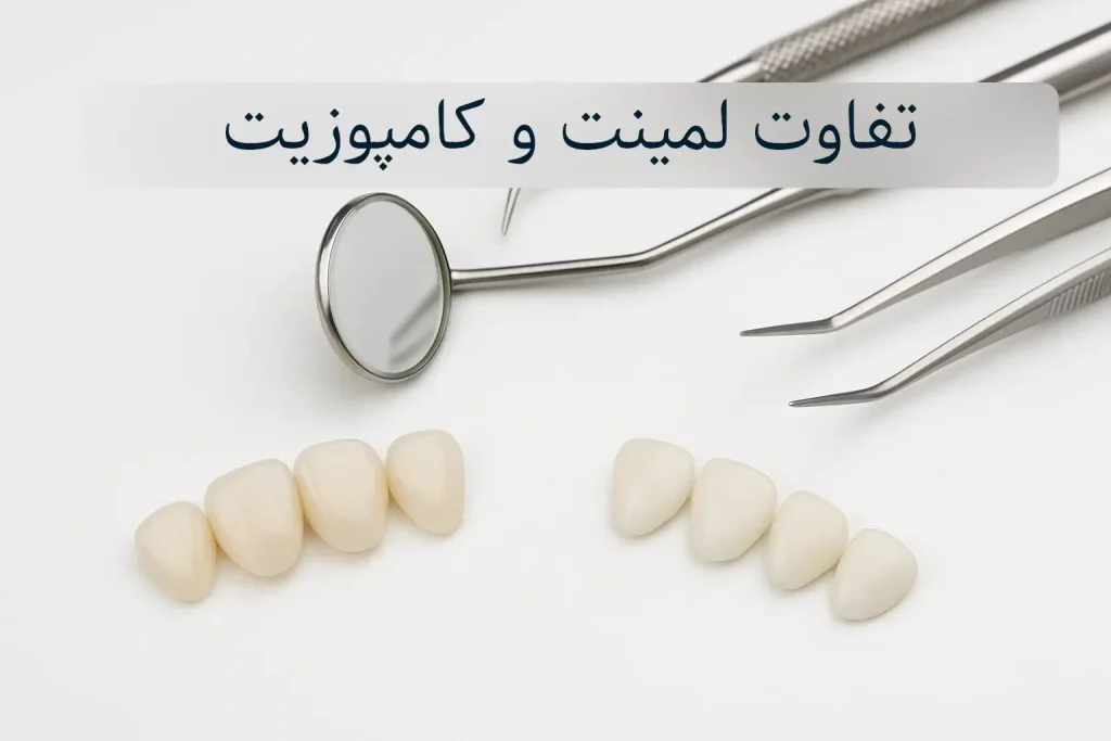 تفاوت لمینت و کامپوزیت دندان