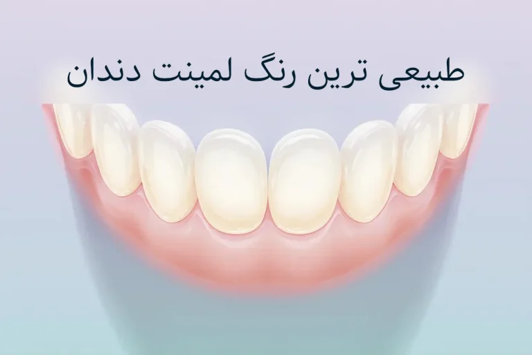 طبیعی ترین رنگ لمینت دندان