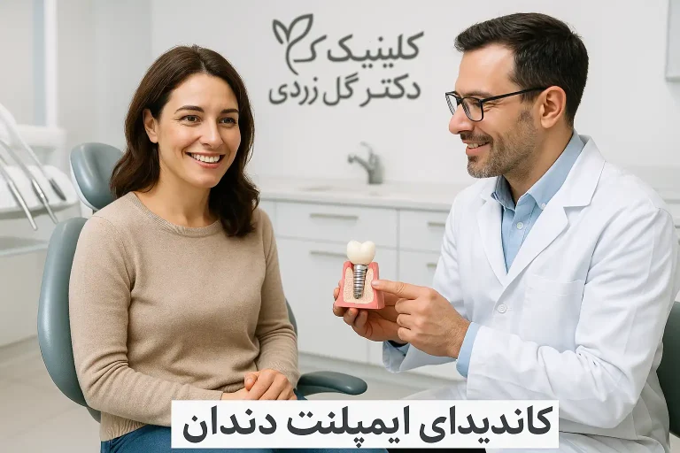 کاندیدای ایمپلنت دندان