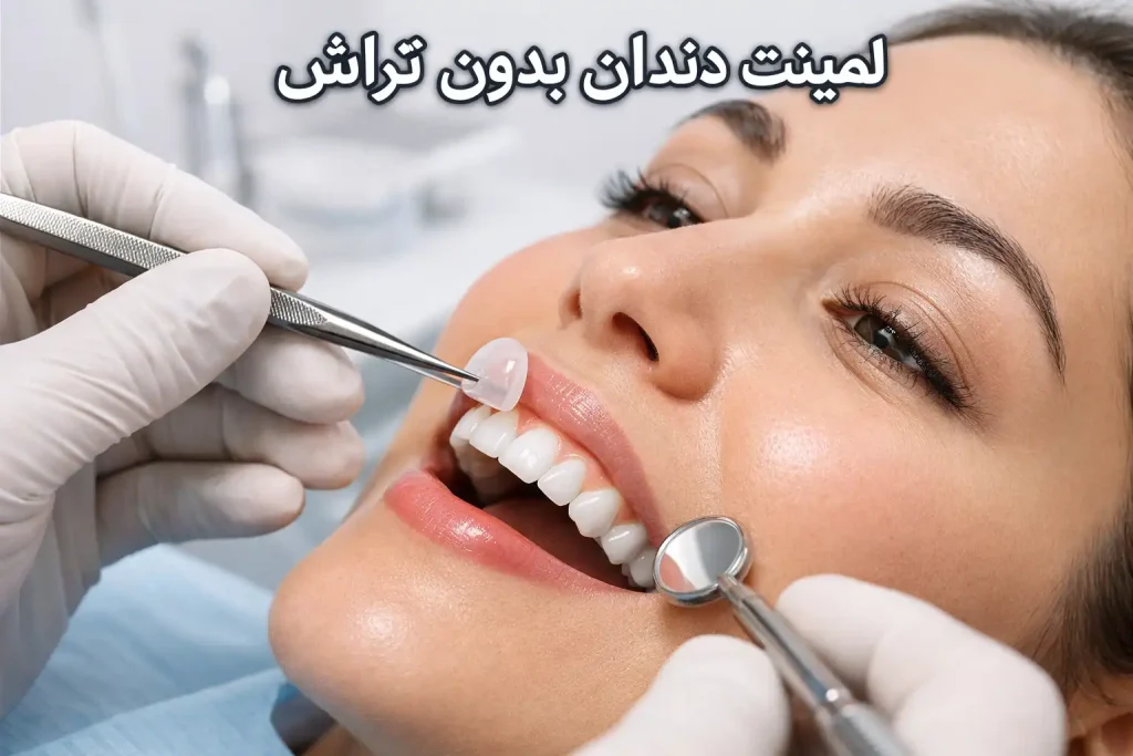 لمینت دندان بدون تراش