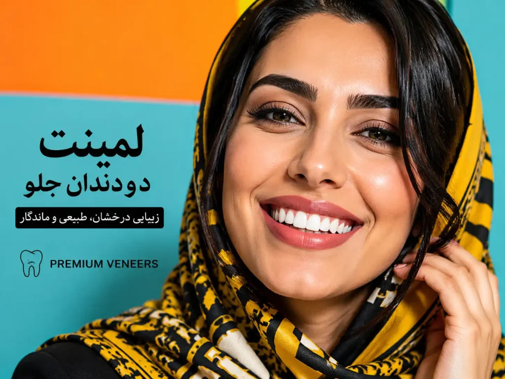 لمینت دو دندان جلو